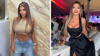 Мис Силикон смени дупето в Колумбия! СНИМКИ 18+